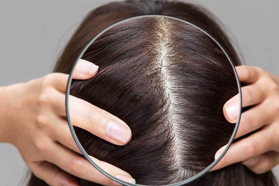 anatomy-of-the-scalp-15161839-230927151618.jpg