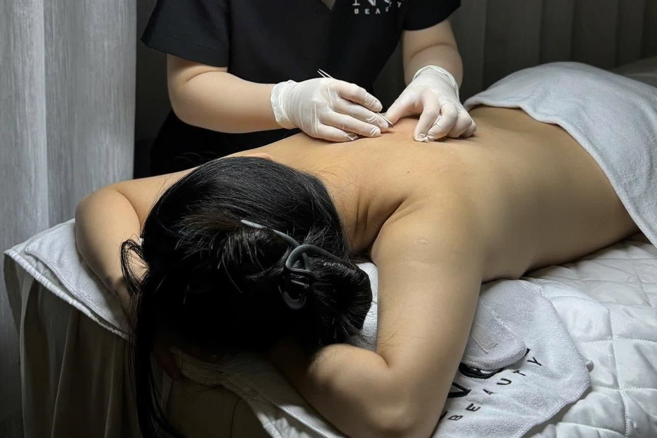 mụn lưng.jpg