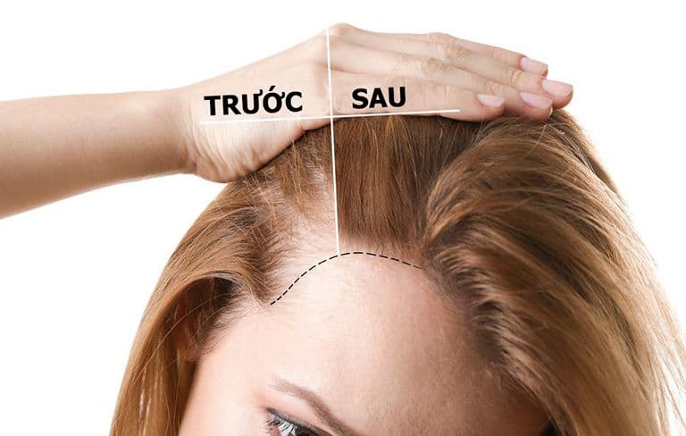 toc-moc-nhanh.jpg